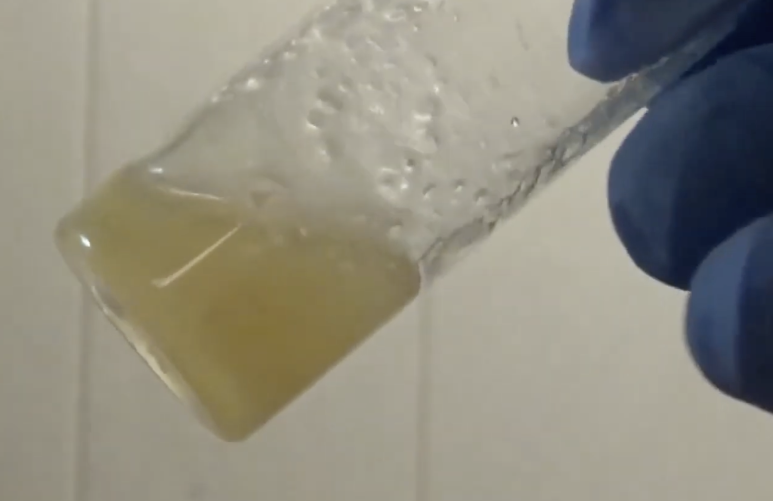 Can Choline Help with Weight Loss? New Studies & EVIDENCE Bio Bean