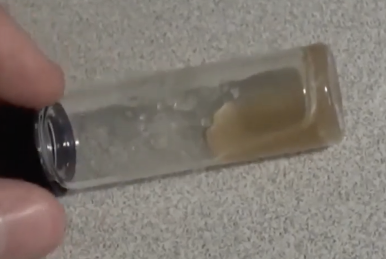 Can Choline Help with Weight Loss? New Studies & EVIDENCE Bio Bean